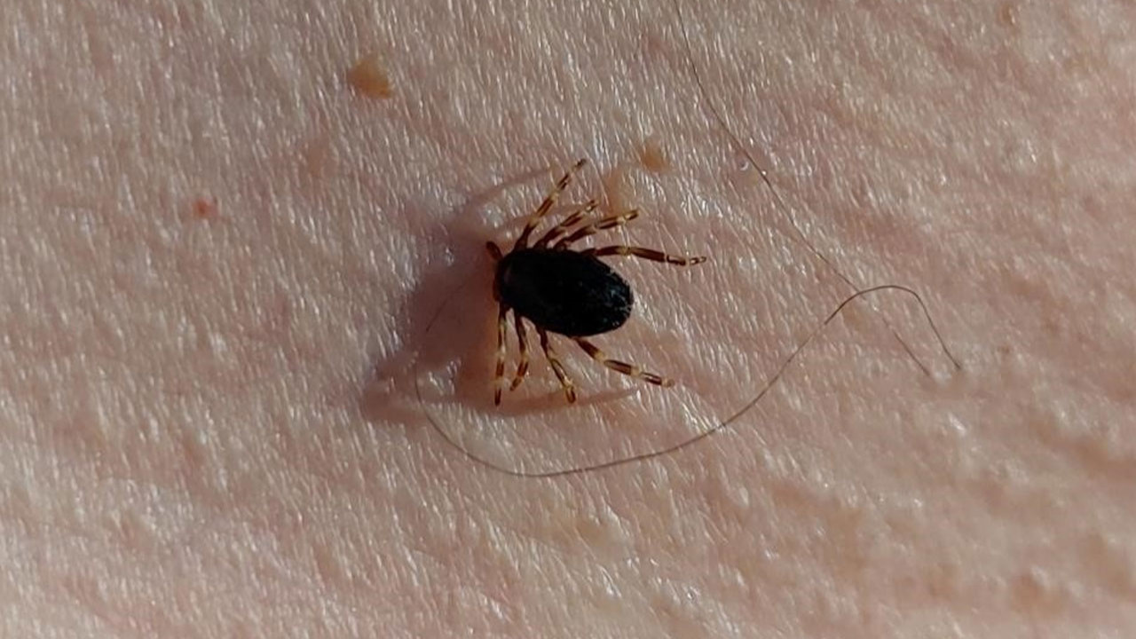 Çorum'da KKKA teşhisi konulan 64 yaşındaki kadın hayatını kaybetti