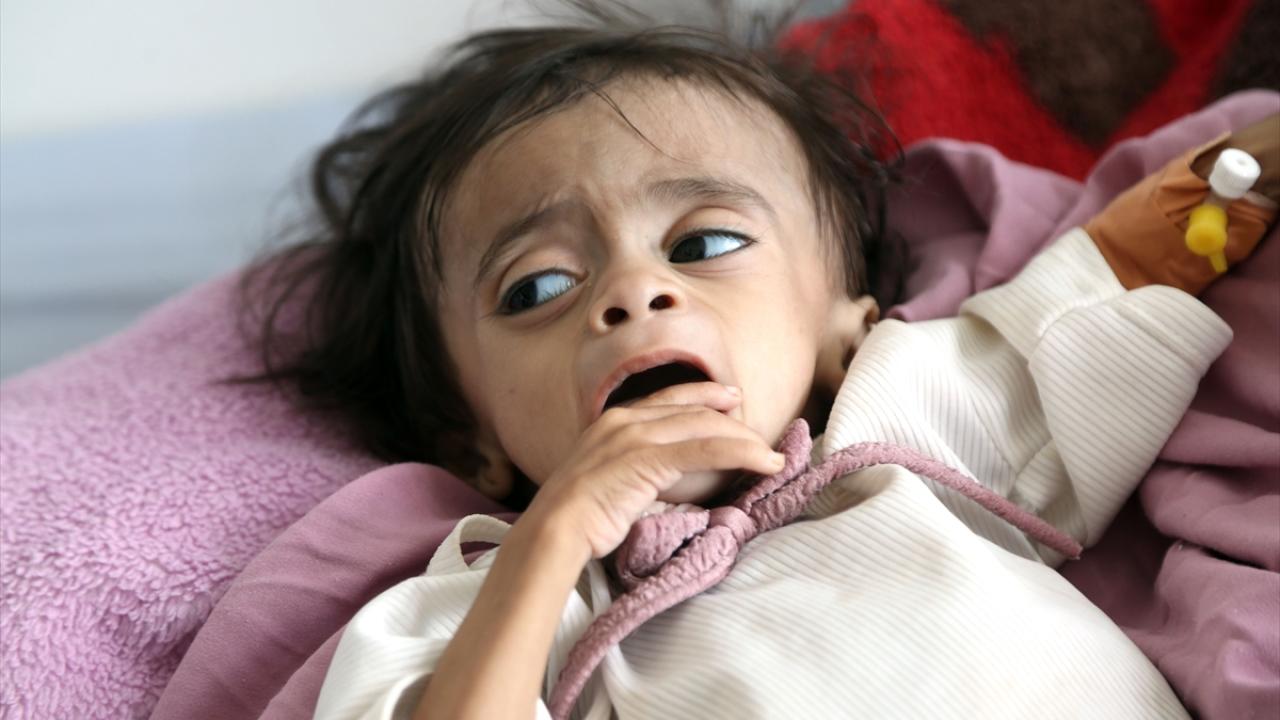 BM, Yemen'de ağustos ayından bu yana 200 binden fazla kişinin yerinden edildiğini bildirdi
