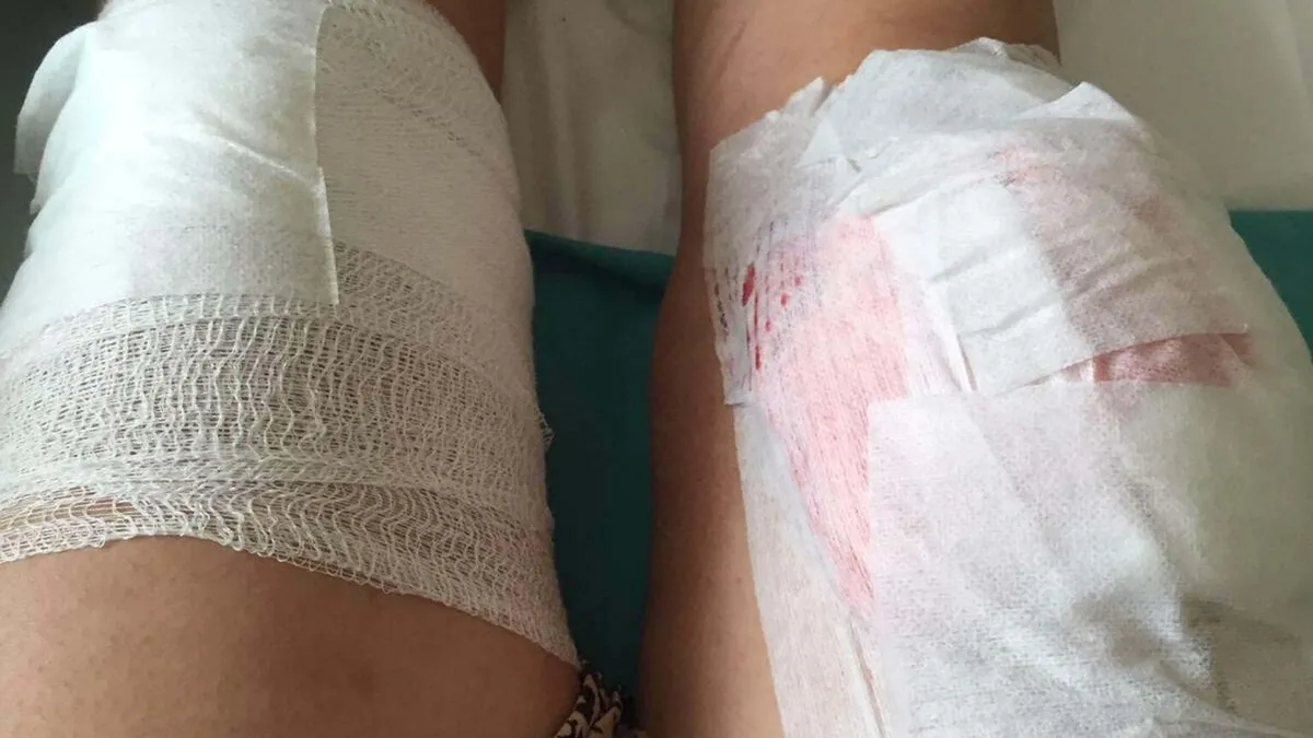 Yargıtay eski eşini vuran sanığın öldürmeye teşebbüs cezasını bozdu